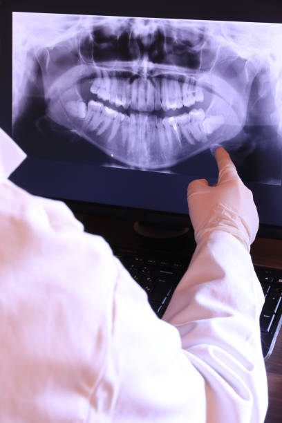 Best Emergency Dental Care for Broken or Chipped Teeth in Elverta, CA